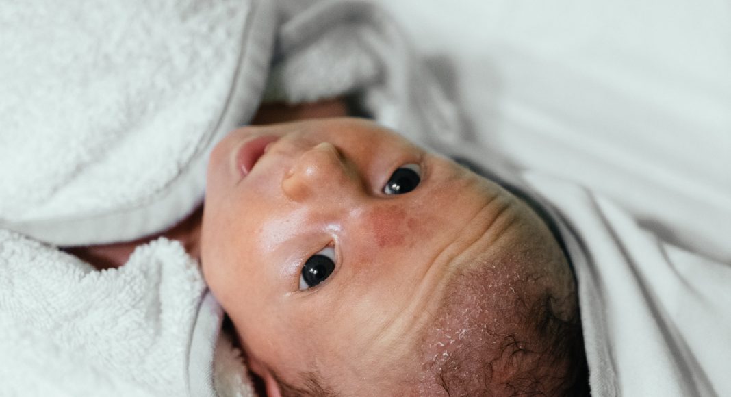 Beba zadobila veliku ranu preko obraza nakon carskog reza